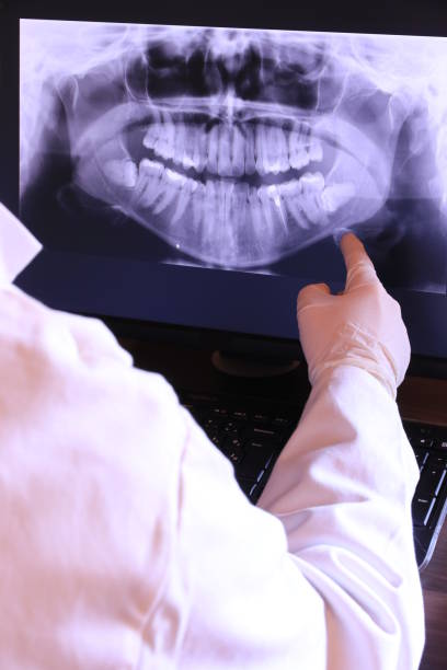 Best Emergency Wisdom Teeth Removal in Stewartville, MN